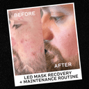 LED Light Therapy Face Mask - Buff